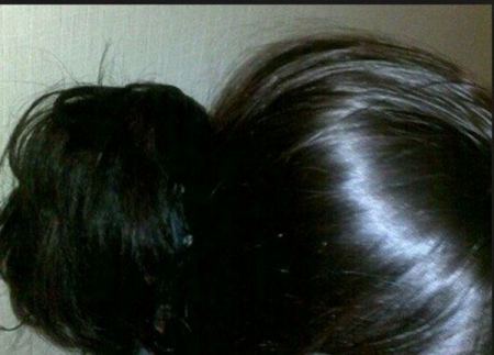 "حشرات الرأس" تقتل سيدة وحفيدتها.. كيف 